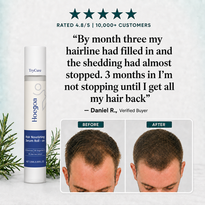 TryCure™ Korean Rosemary Hair Serum