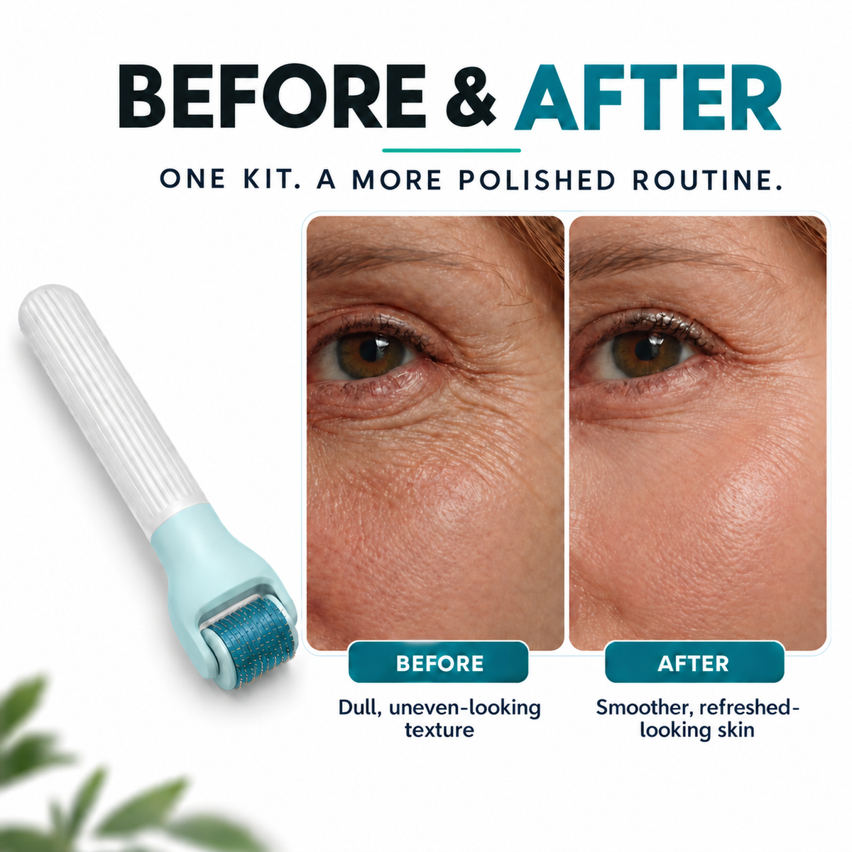 TryCure® 10 in 1 Derma Roller Kit — before and after visualization
