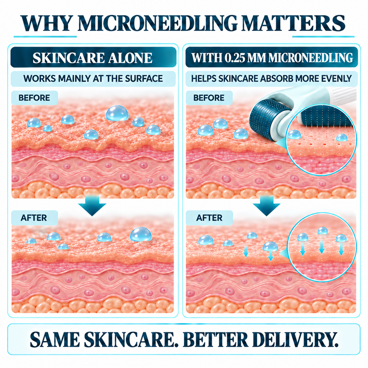 TryCure® 10 in 1 Derma Roller Kit — why microneedling matters