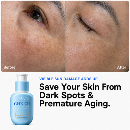 Illustrative before-and-after comparison of visible sun-damaged skin; individual results vary.