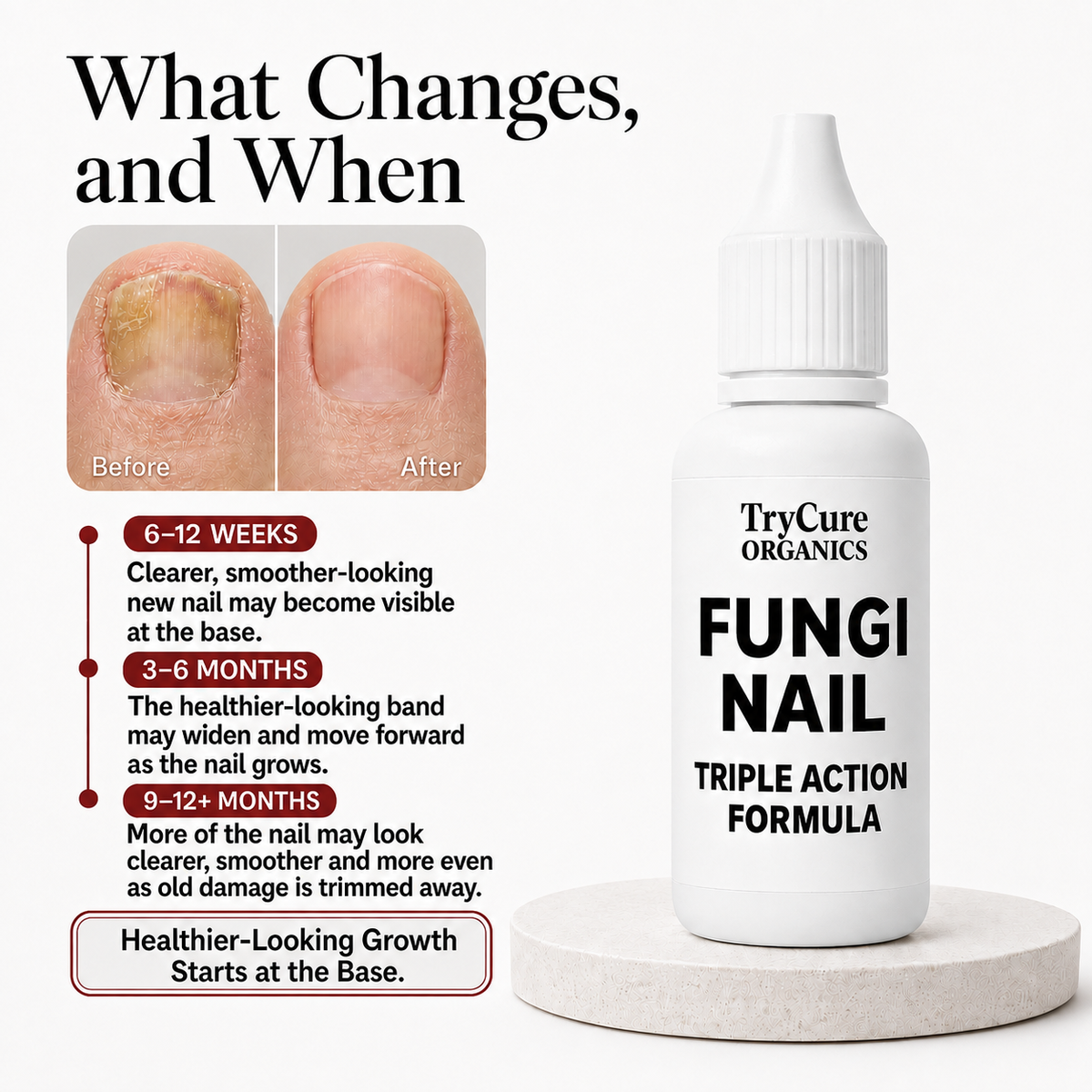 TryCure® nail grow-out timeline showing illustrative visible changes from 6–12 weeks through 9–12+ months; results vary.
