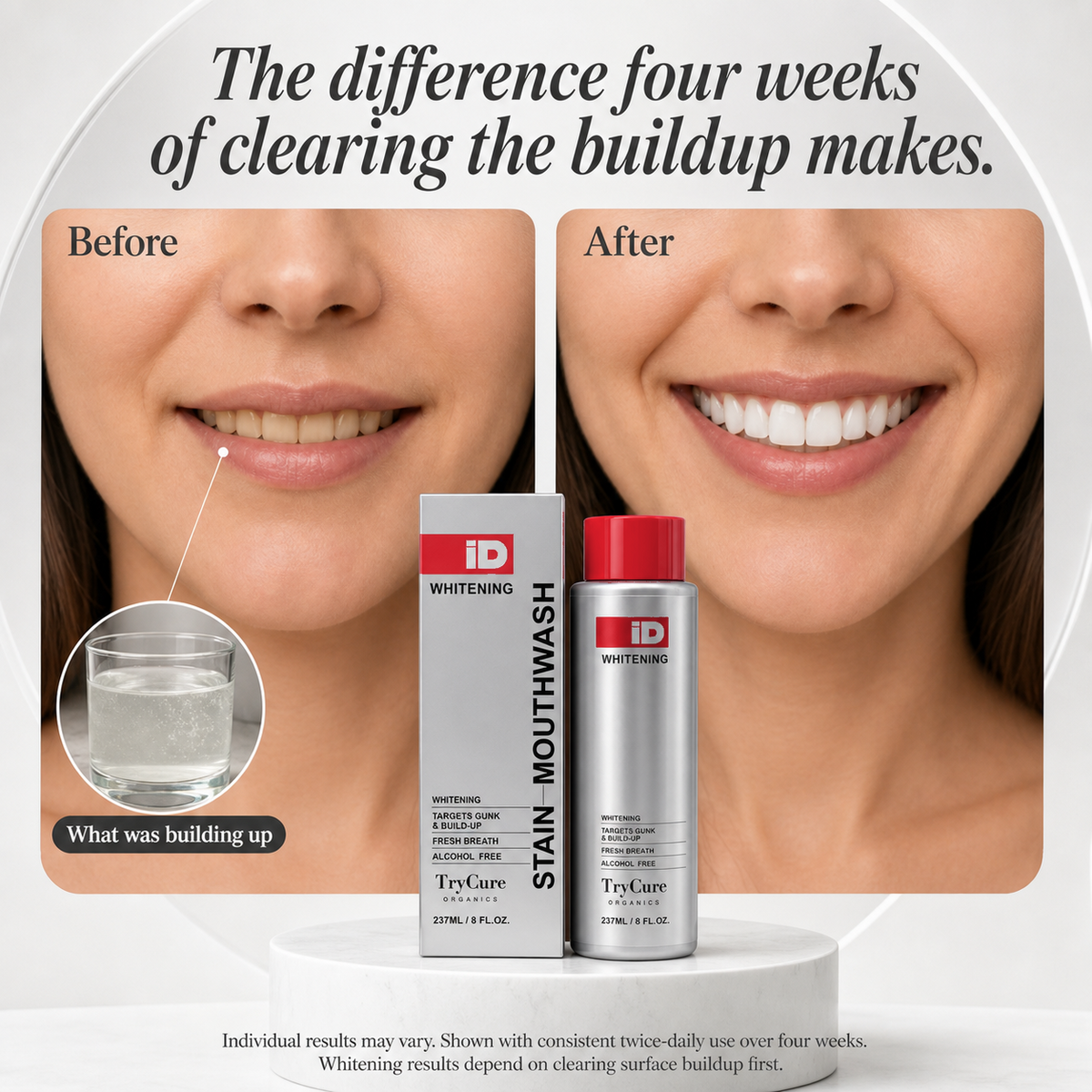 TryCure Hydrogen Peroxide Whitening Mouthwash — 02 of 07 — four-week before and after